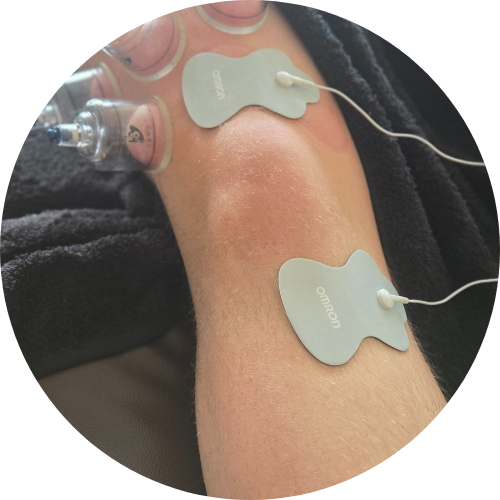 TENS Therapy